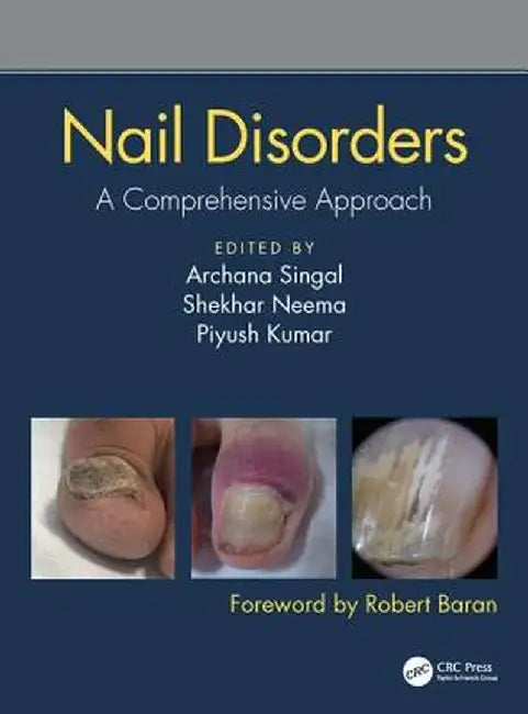 Nail Disorders: A Comprehensive Approach by Archana Singal