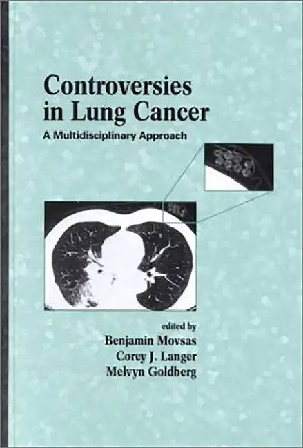 Controversies In Lung Cancer: A Multidisciplinary Approach by Benjamin Movsas, Corey J. Langer