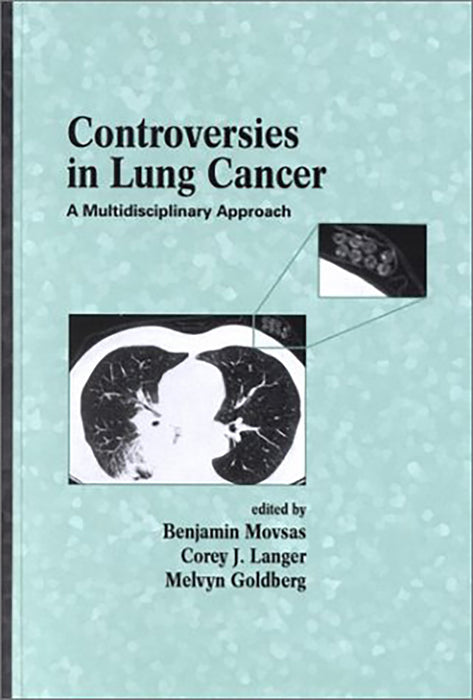 Controversies In Lung Cancer: A Multidisciplinary Approach