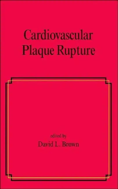 Cardiovascular Plaque Rupture by David Brown