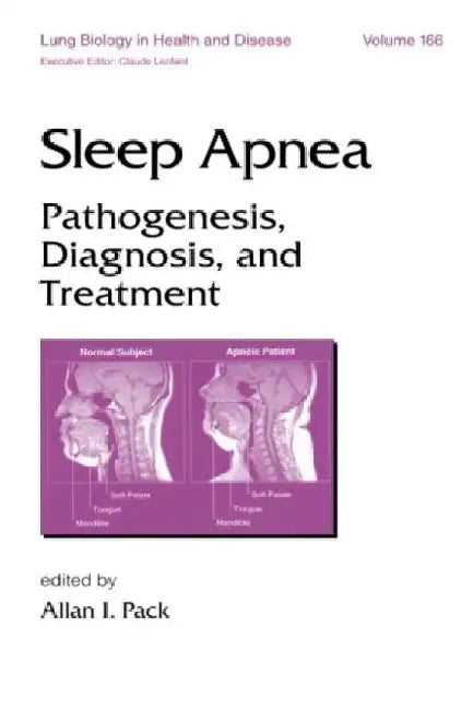 Sleep Apnea by Allan I. Pack