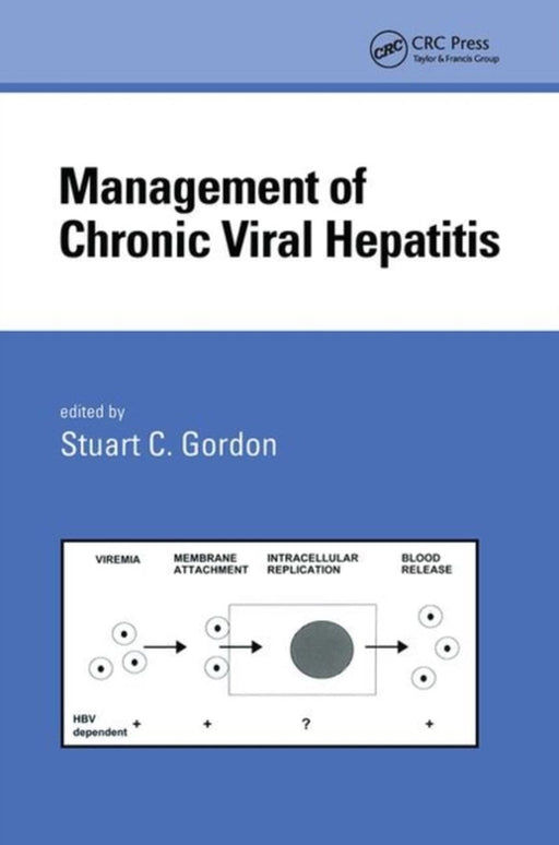 Management Of Chronic Viral Hepatitis by Stuart Gordon