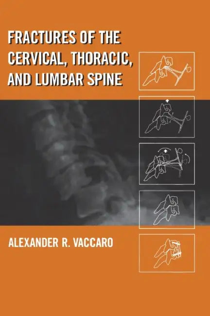 Fractures of the Cervical, Thoracic, and Lumbar Spine by Alexander R. Vaccaro