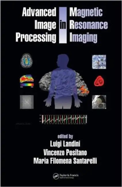 Advanced Image Processing in Magnetic Resonance Imaging by Luigi Landini, Vincenzo Positano, Maria Santarelli