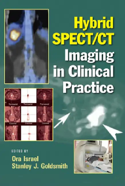 Hybrid SPECT/CT Imaging in Clinical Practice by Ora Israel