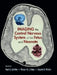 Imaging the Central Nervous System of the Fetus and Neonate by Paul D. Griffiths