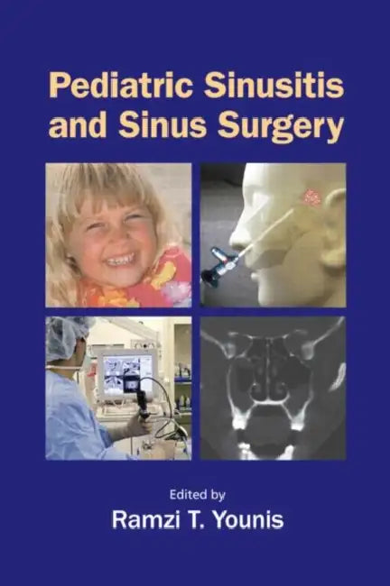 Pediatric Sinusitis and Sinus Surgery by Ramzi T. Younis