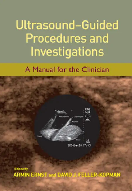 Ultrasound-Guided Procedures And Investigations: A Manual For The Clinician by Armin Ernst