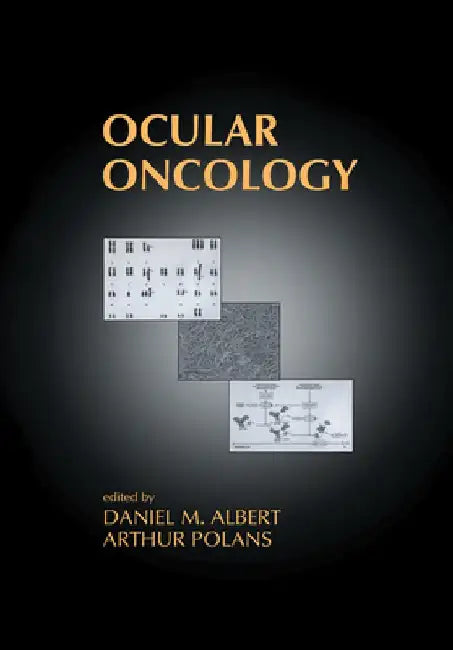 Ocular Oncology 