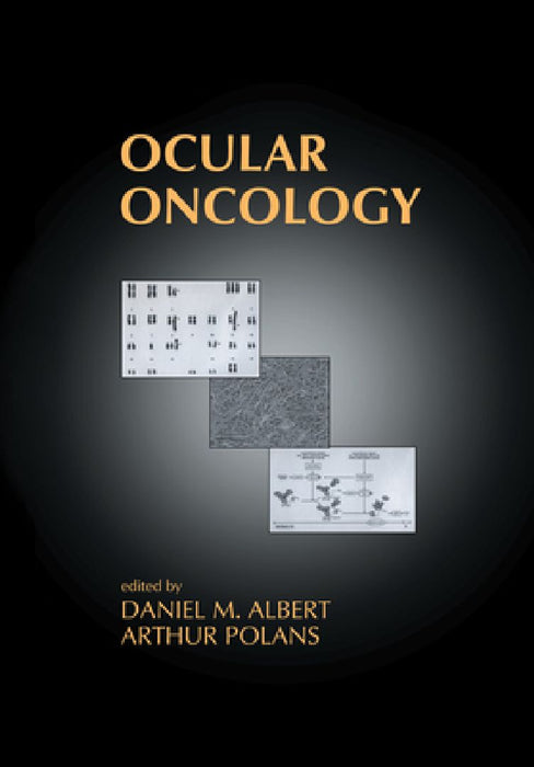 Ocular Oncology  by Daniel M. Albert