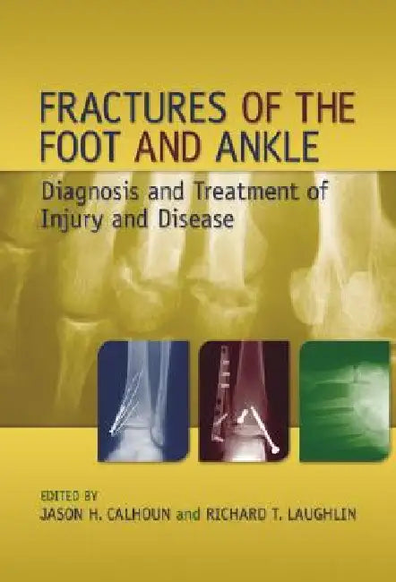 Fractures of the Foot and Ankle: Diagnosis and Treatment of Injury and Disease by Jason H. Calhoun
