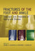 Fractures of the Foot and Ankle: Diagnosis and Treatment of Injury and Disease by Jason H. Calhoun