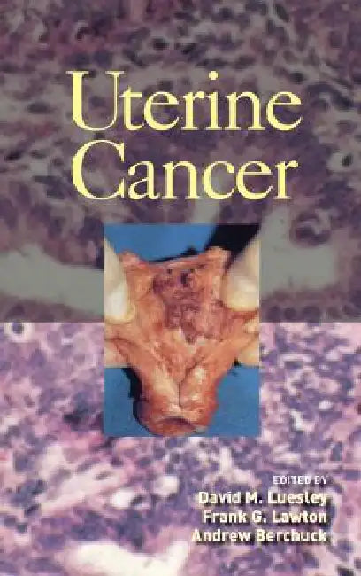 Uterine Cancer by Luesley David M.