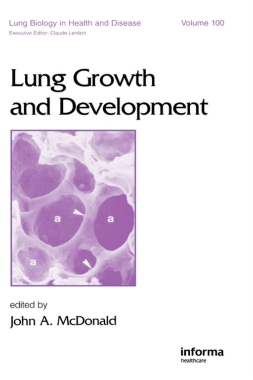 Lung Growth And Development by John A. McDonald