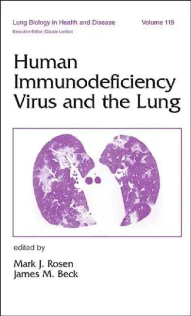Human Immunodeficiency Virus And The Lung by Mark J. Rosen, James M. Beck