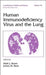 Human Immunodeficiency Virus And The Lung by Mark J. Rosen, James M. Beck