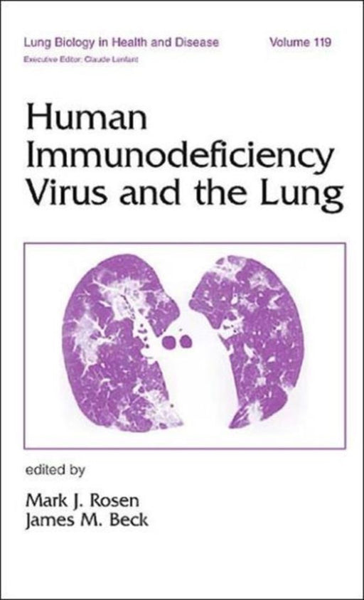 Human Immunodeficiency Virus And The Lung by Mark J. Rosen, James M. Beck