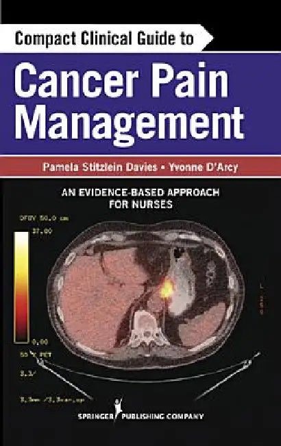 Compact Clinical Guide to Cancer Pain Management: An Evidence-Based Approach for Nurses by Pamela Davies, Yvonne D'Arcy, Yvonne D'Arcy