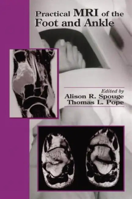 Practical MRI of the Foot and Ankle by Alison R. Spouge