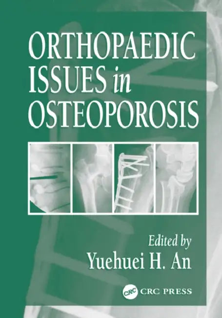 Orthopaedic Issues in Osteoporosis by Yuehuei H. An