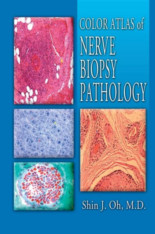 Color Atlas Of Nerve Biopsy Pathology by Shin J. Oh