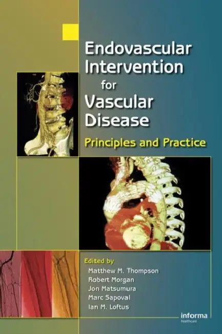 Endovascular Intervention for Vascular Disease: Principles and Practice by Matt M. Thompson, Robert A. Morgan, Jon S. Matsumura