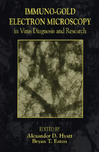 Immuno-Gold Electron Microscopy in Virus Diagnosis and Research by Alexander D. Hyatt