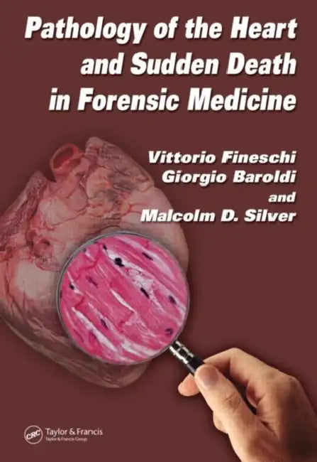 Pathology of the Heart and Sudden Death in Forensic Medicine by Vittorio Fineschi