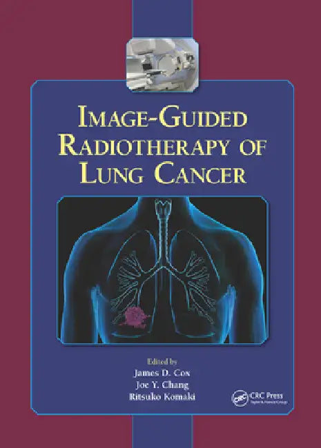 Image-Guided Radiotherapy of Lung Cancer by James D. Cox