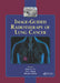 Image-Guided Radiotherapy of Lung Cancer by James D. Cox