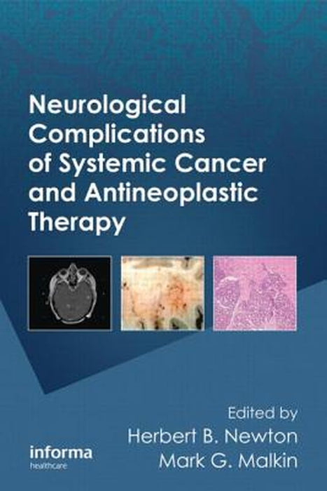 Neurological Complications of Systemic Cancer and Antineoplastic Therapy by Herbert B. Newton