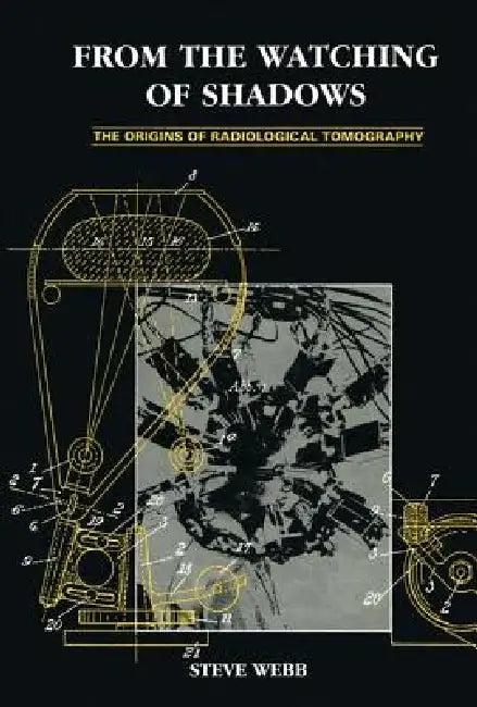 From the Watching of Shadows: The Origins of Radiological Tomography by S. Webb