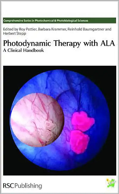 Photodynamic Therapy With Ala: A Clinical Handbook by The European Society of Photobiology, Others