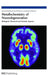 Metallochemistry Of Neurodegeneration: Biological, Chemical and Genetic Aspects by Henryk Kozlowski, David Brown, Gianni Valensin