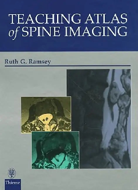 Teaching Atlas Of Spine Imaging 