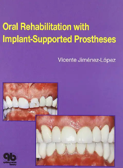 Oral Rehabilitation with Implant-Supported Prostheses by Jimenez-Lopez