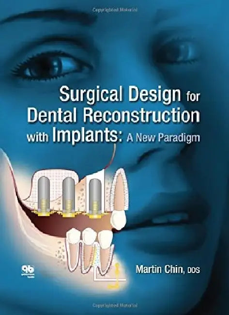 Surgical Design for Dental Reconstruction with Implants: A New Paradigm by Chin