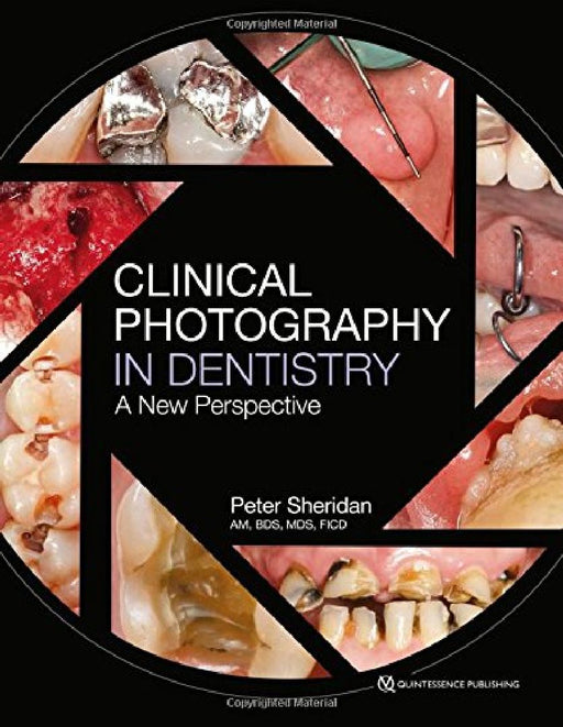 Clinical Photography in Dentistry: A New Perspective by Peter Sheridan