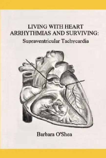 Living with Heart Arrhythmias and Surviving: Supraventricular Tachycardia by Barbara O'Shea