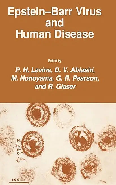 Epstein-Barr Virus and Human Disease by P. H. Levine, D. V. Ablashi, M. Nonoyama