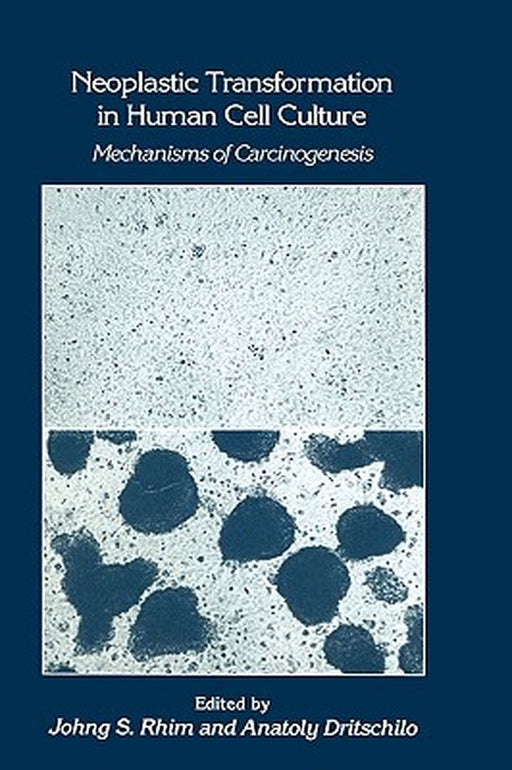 Neoplastic Transformation in Human Cell Culture: Mechanisms of Carcinogenesis by Johng S. Rhim