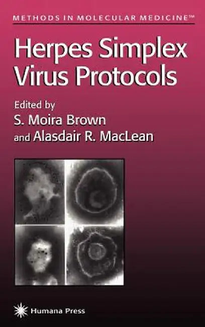 Herpes Simplex Virus Protocols by S. Moira Brown