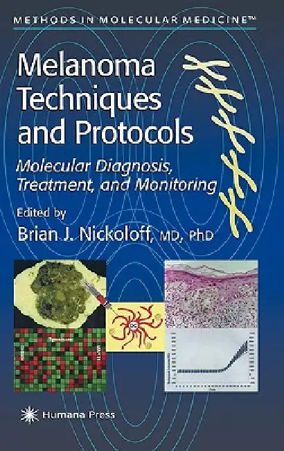 Melanoma Techniques and Protocols: Molecular Diagnosis, Treatment, and Monitoring by Brian J. Nickoloff