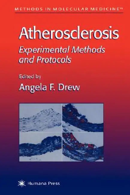 Atherosclerosis: Experimental Methods and Protocols by Angela F. Drew