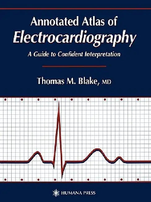 Annotated Atlas of Electrocardiography: A Guide to Confident Interpretation by Thomas M. Blake