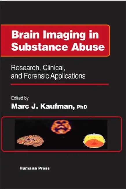 Brain Imaging in Substance Abuse: Research, Clinical, and Forensic Applications by Marc J. Kaufman