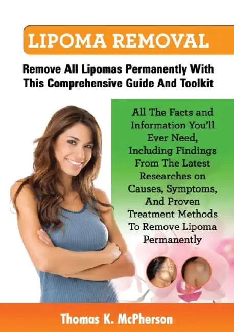 Lipoma Removal, Lipoma Removal Guide. Discover All the Facts and Information on Lipoma, Fatty Lumps by McPherson, Thomas K.