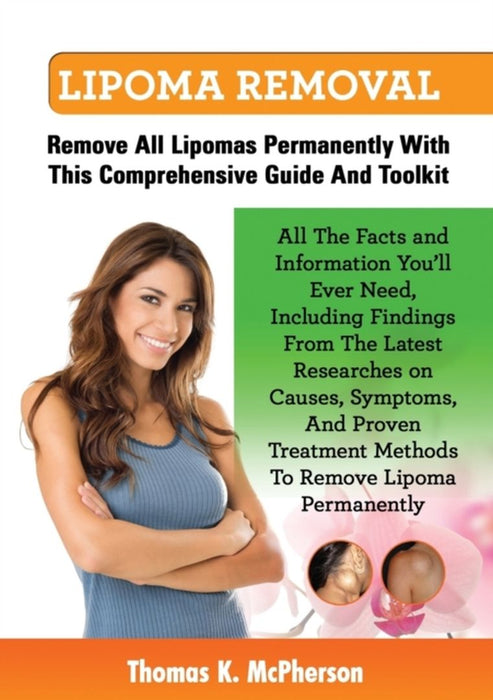 Lipoma Removal, Lipoma Removal Guide. Discover All the Facts and Information on Lipoma, Fatty Lumps by McPherson, Thomas K.
