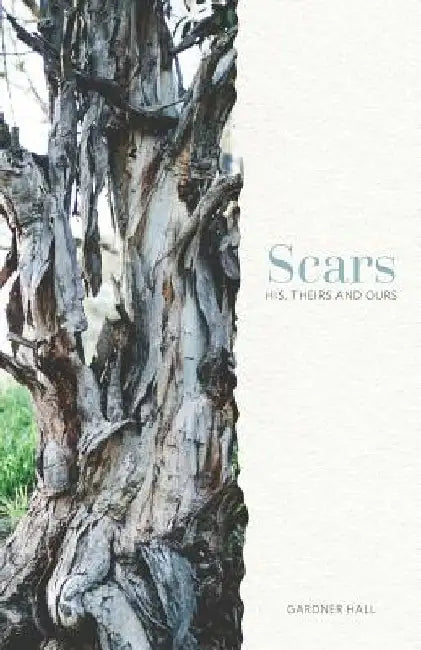Scars: His, Theirs and Ours by Gardner Hall