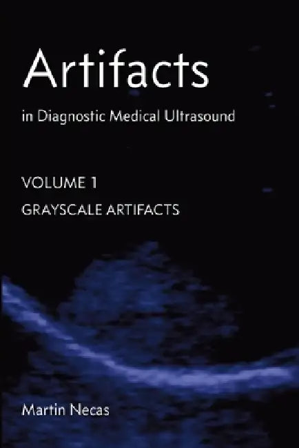 Artifacts in Diagnostic Medical Ultrasound: Grayscale Artifacts by Martin Necas